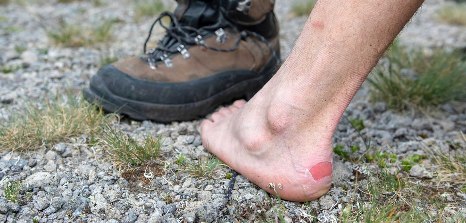 Vesciche?! No grazie! Tutti i consigli e le accortezze da seguire.